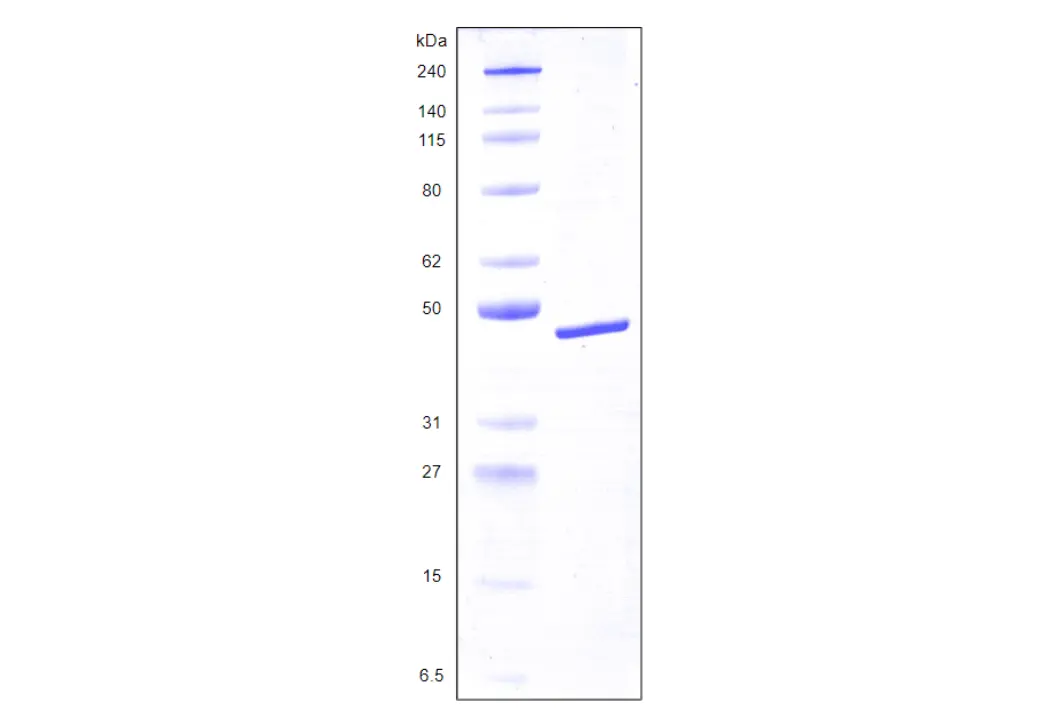 Recombinant Human Galectin 8, variant 2, His Tag (359 a.a.) -25 ug